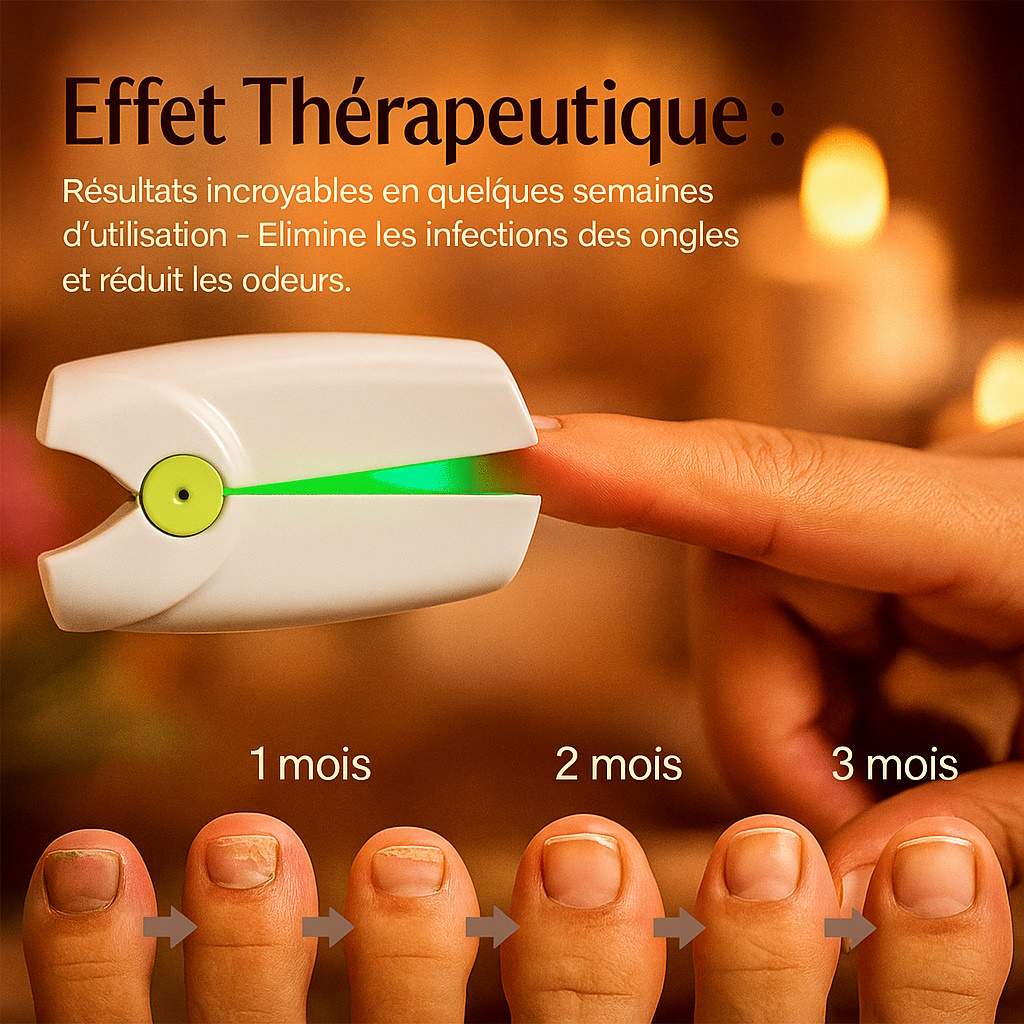 PURENAILS™ - Traitement fongique des ongles à domicile